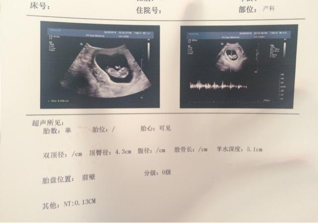孕期这两种孕检，医生会让你只做一项，孕妈们别听，全部得做