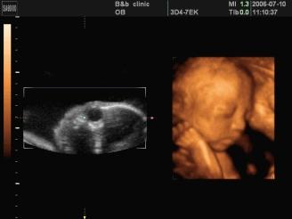 怀孕6个月，宝宝四维拍照嘴巴和鼻子都好大，生出来后是不是很丑