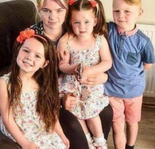 国外一4岁女童患怪病，身体两边都不对称