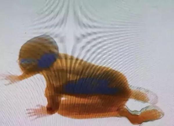 2018儿童安全事故大盘点：这8大隐患威胁孩子安全