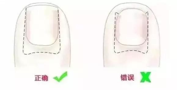 乱给宝宝剪指甲真的很严重，不信你来看……