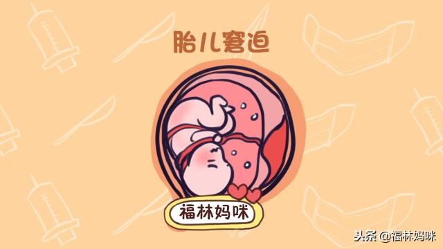 生孩子最怕遇到这3种紧急情况！准妈妈做到心里有谱，才不慌！