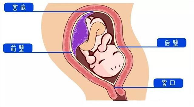 孕产说：胎盘前壁后壁哪个安全？还有哪些是需要注意的呢？