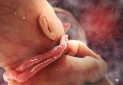 如果你怀孕了，一定要做好这3件事，有助于让宝宝远离脐带绕颈