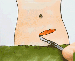 怀孕36周可以剖腹产吗？看这6个问题10个情况，再做决定吧