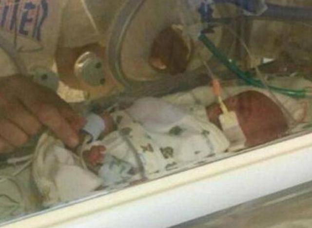 37岁脑瘤孕妈，为宝宝果断放弃治疗，下葬日宝宝也不幸去世