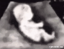 产检时彩超医生检查到一半笑喷了，看不出这小家伙还是个老司机啊