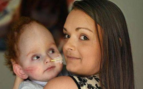 英国男婴出生没完整大脑，医生称活不了几天，如今2岁会喊妈妈！