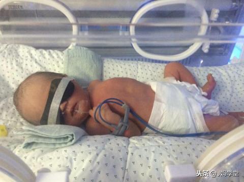 33岁妈妈为了求子，扎千针七次取卵，婴儿26周早产仍在抢救