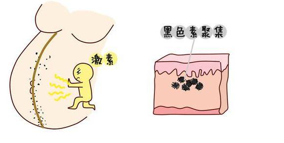 孕妇妊娠线下面居中上面偏左，是有什么征兆吗？了解这些情况秒懂