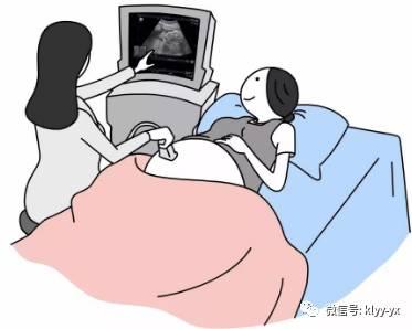胎心监护，产科医生一般不会告诉你这么多