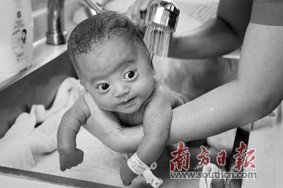 出生仅有400克，他活下来了