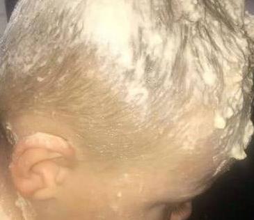 3岁宝宝往头发上抹整罐凡士林 妈妈洗了6小时23次