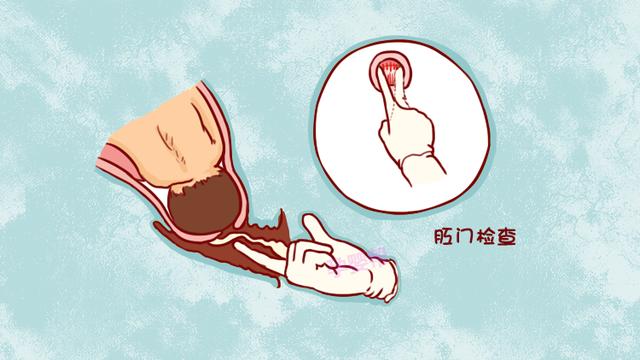 顺产时医生说的“开十指”，真的是把十根手指伸进去量？