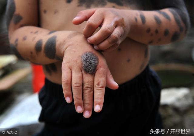 6岁“毛孩”两岁遭抛弃，全身70%布满黑点和绒毛，绒毛长3厘米