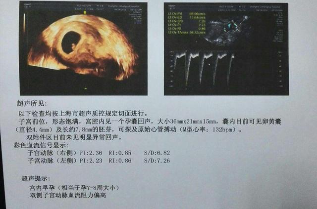 孕期第1次产检可做3项检查，最重要的是第1项，这些情况早知道好