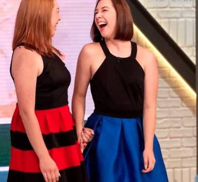 连体婴儿7个月时做分离手术 现在已是17岁漂亮女孩