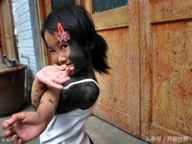 6岁“毛孩”两岁遭抛弃，全身70%布满黑点和绒毛，绒毛长3厘米