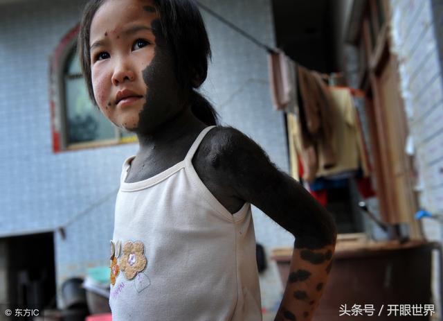 6岁“毛孩”两岁遭抛弃，全身70%布满黑点和绒毛，绒毛长3厘米