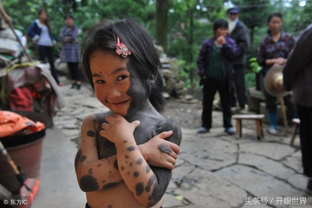 6岁“毛孩”两岁遭抛弃，全身70%布满黑点和绒毛，绒毛长3厘米