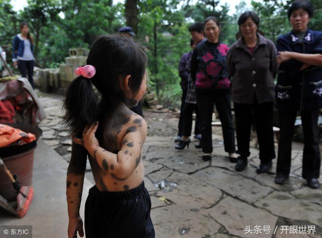 6岁“毛孩”两岁遭抛弃，全身70%布满黑点和绒毛，绒毛长3厘米