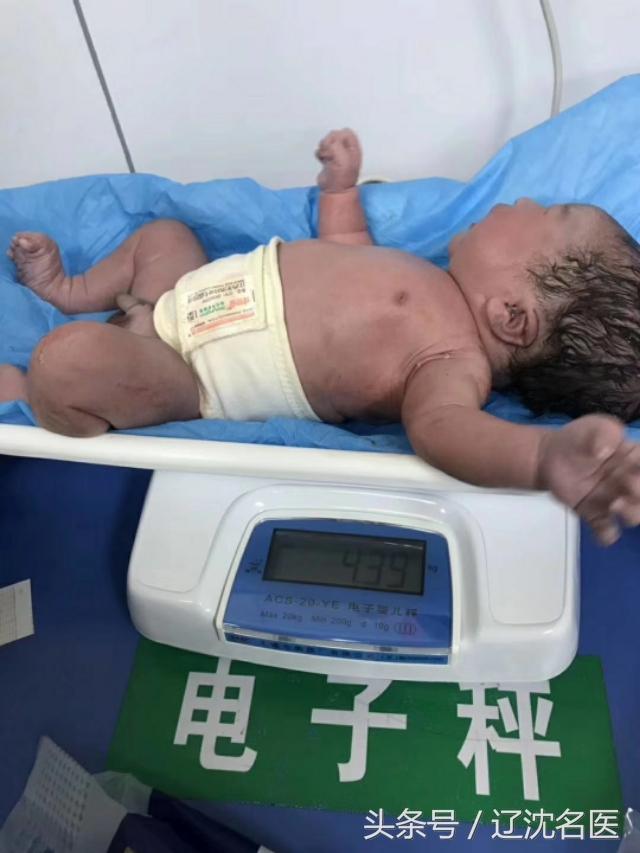 我,是一个8.8斤的巨大儿,嘿嘿……