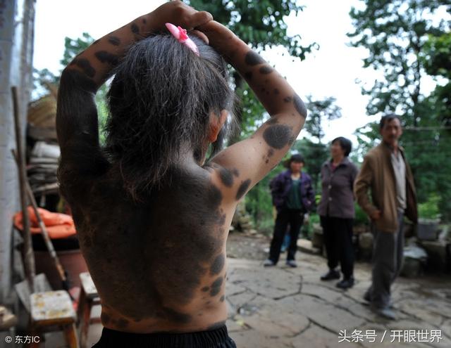 6岁“毛孩”两岁遭抛弃，全身70%布满黑点和绒毛，绒毛长3厘米