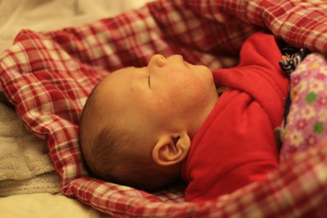 奶藓？湿疹？傻傻分不清楚，可把母乳喂养的宝妈给愁坏了