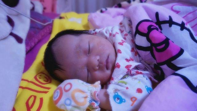 奶藓？湿疹？傻傻分不清楚，可把母乳喂养的宝妈给愁坏了