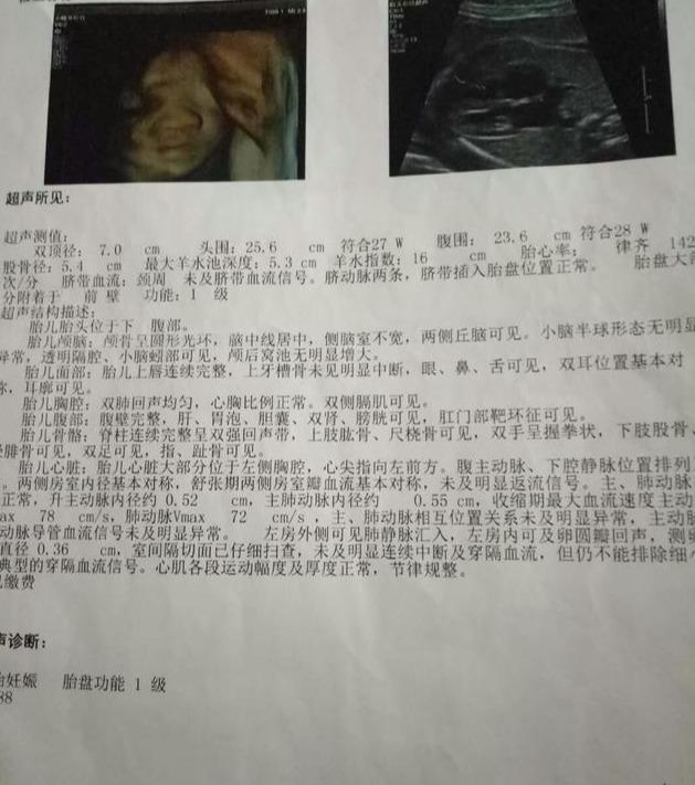 亲测最准！四维彩超的一个数据决定你肚子里是男娃女娃！