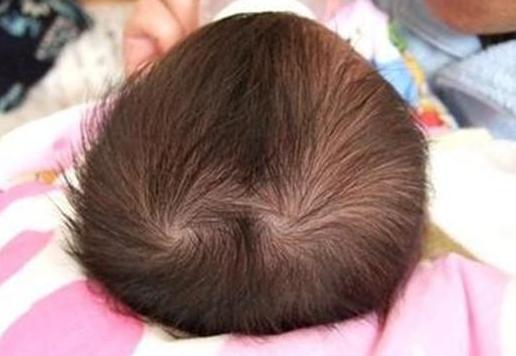 看孩子头上长什么样的旋儿，就能够知道这个人的命运吗？