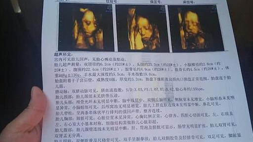 亲测最准！四维彩超的一个数据决定你肚子里是男娃女娃！