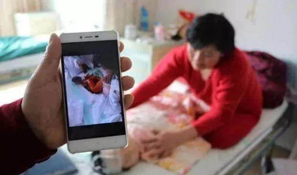 冬天宝宝最容易受到这种伤害！别怕，一分钟教你如何快速处理！