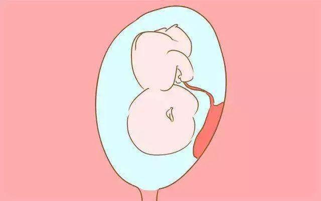 你见过出生时脑门贴着环的宝宝吗？畸形的胎儿父母要查染色体