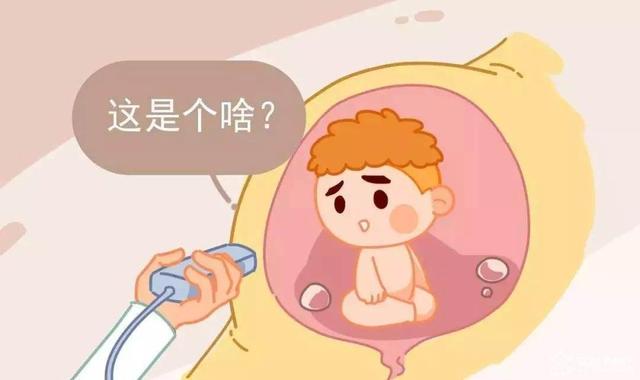 做大排畸时医生说了1句话，孕妇猜了大半天，估计是这3个意思
