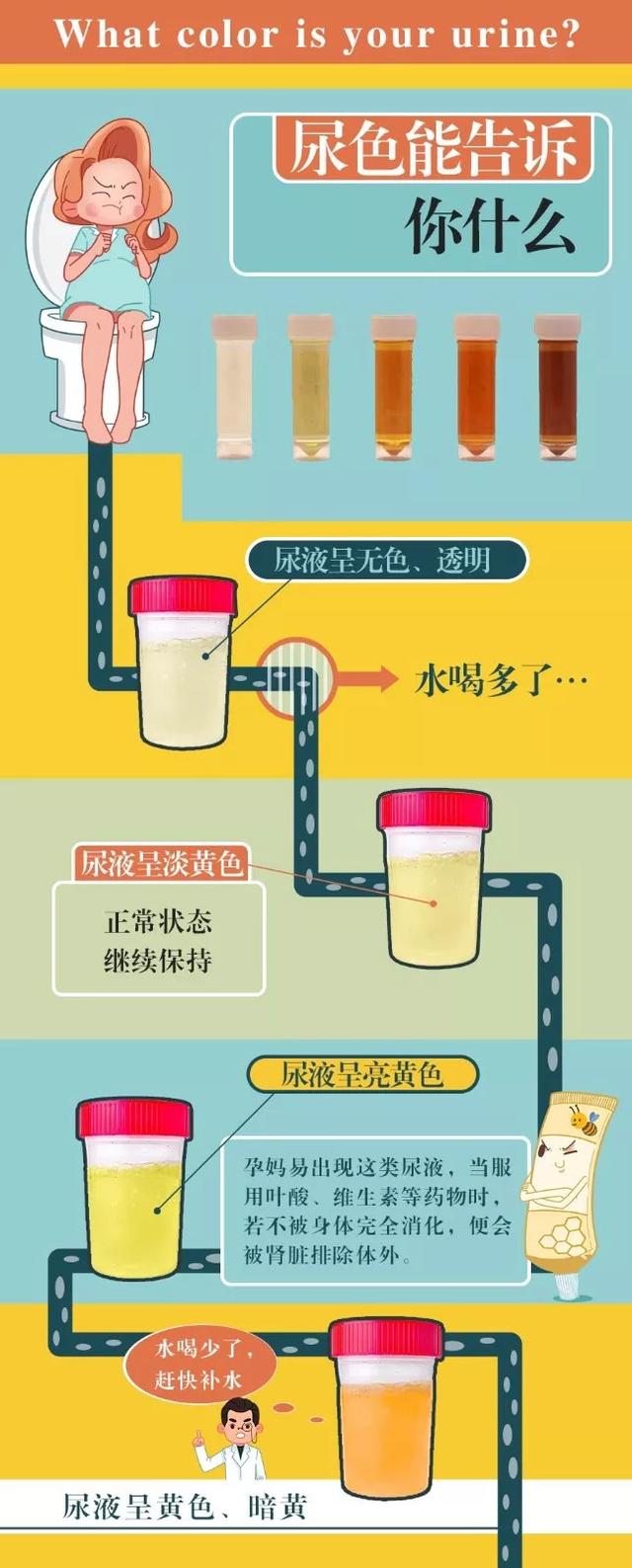孕妈尿液的颜色可以反映身体状况，还能反映胎儿性别？是真的吗？