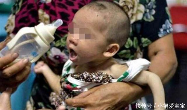 两岁孩子体重18斤，母亲起疑带去医院检查，医生悄悄报了警