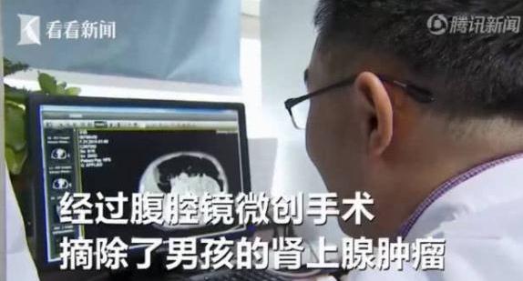 12岁男孩胸和橘子一样大，举止像女孩，医生检查结果令家长担忧