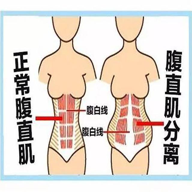 怀孕后，屁股也大了是怎么回事，还能恢复原样吗，你知道吗？