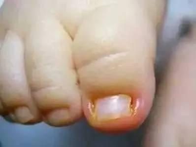 后悔死了，宝妈们千万不要这样给宝宝剪指甲！