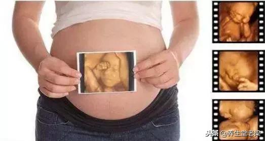 孕期查出这个病，孩子真的不能要吗？