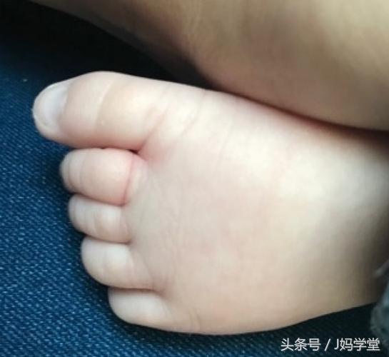妈妈注意了：你身上的这个东西，可能会让宝宝致残！一定要检查