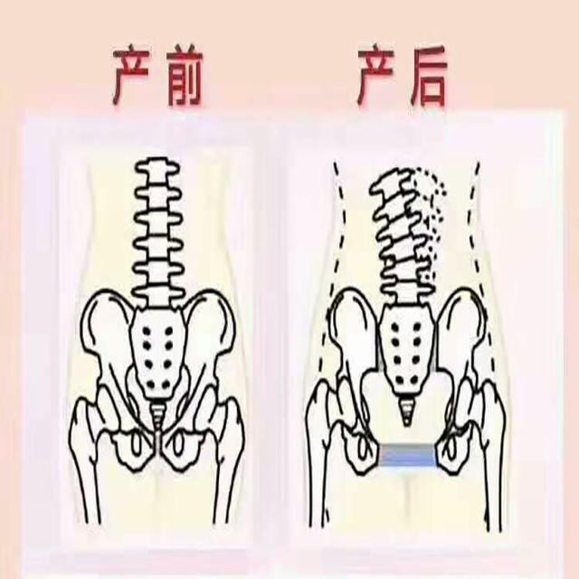 怀孕后，屁股也大了是怎么回事，还能恢复原样吗，你知道吗？