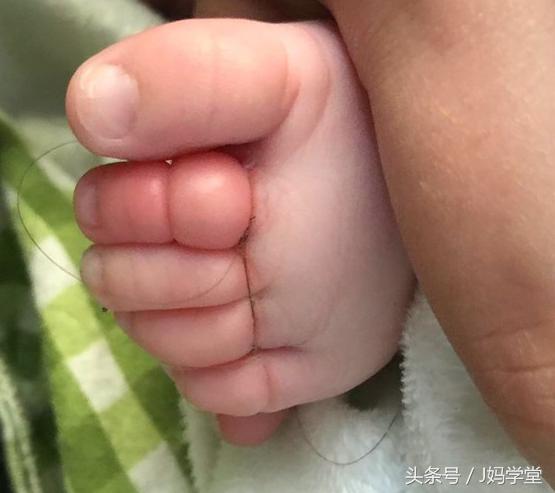 妈妈注意了：你身上的这个东西，可能会让宝宝致残！一定要检查