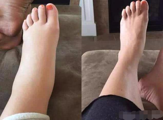 孕晚期，准妈妈身体的这2个“变化”，你正在经历哪一个？