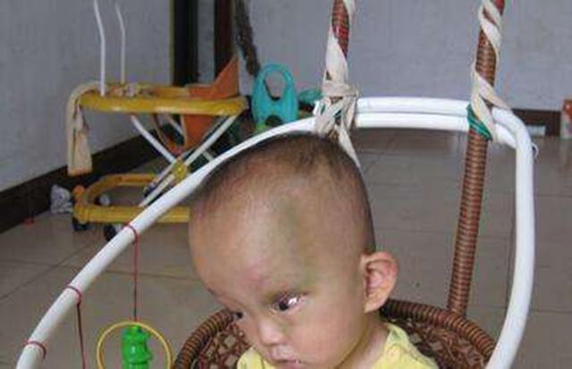 宝宝7个月时被查出脑瘫，医生怒斥太无知，只因爸爸这动作
