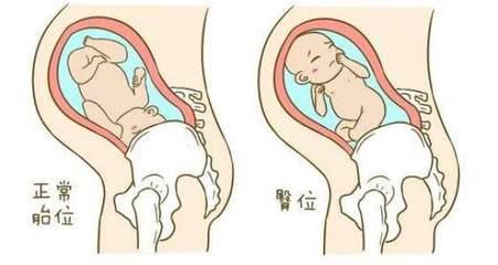 怀孕后胎位什么时候才可以定下来？想要顺产的妈妈们可以了解一下