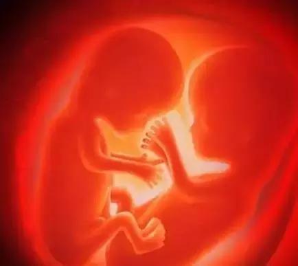 为什么要叫“羊水”，跟羊有关系？