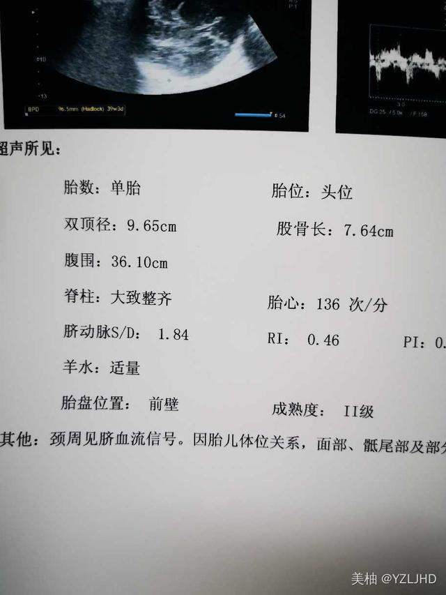 7.7斤男宝宝，水囊催产无侧切无撕裂，来还愿了，分享孕期反应