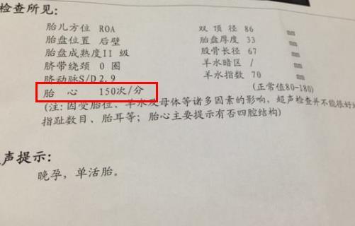 孕妈多研究一下B超单，医生不告诉胎儿性别，B超单会告诉你！